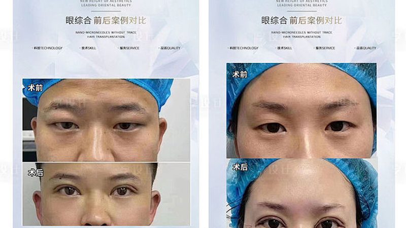 广州注射类医疗美容材料：如何选择安全与有效的产品**