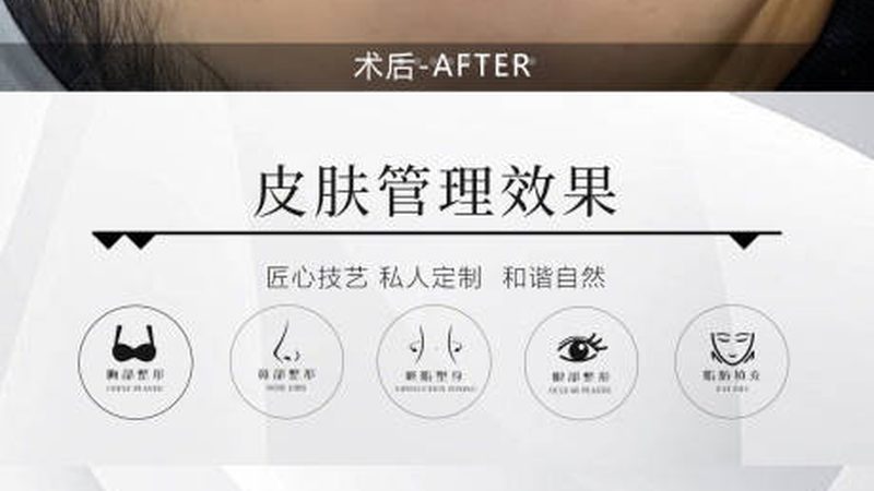 透明质酸：天然保湿，效果自然