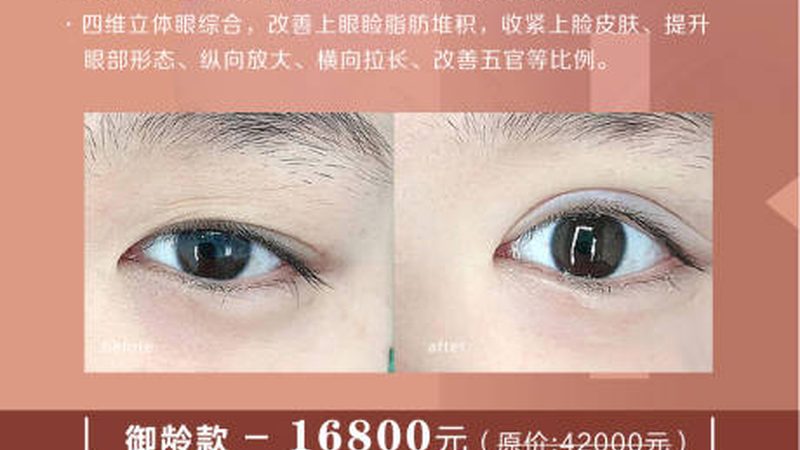 激光美容仪器售后服务哪家好？揭秘关键因素