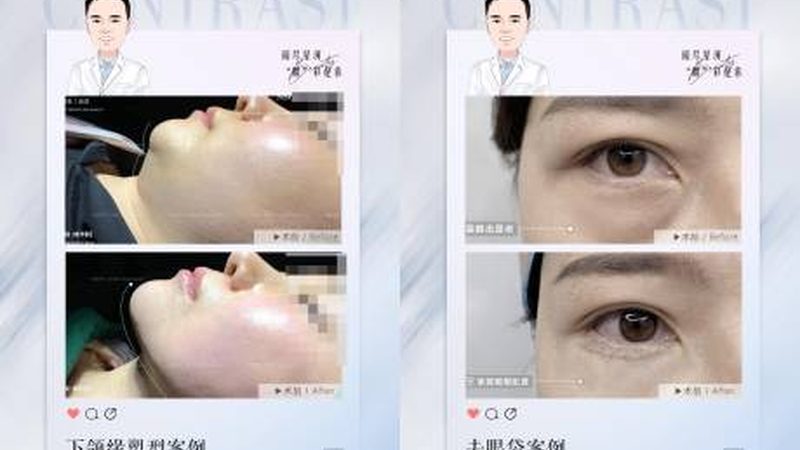 揭秘注射美容：如何从十大品牌排名中找到适合你的产品