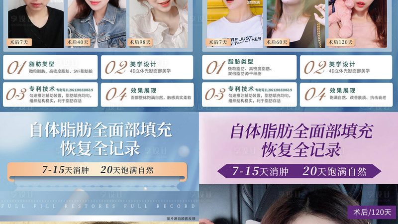 埋线提升：紧致肌肤，恢复青春