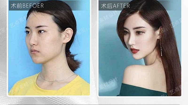 热门医美项目，价格与口碑背后的真相
