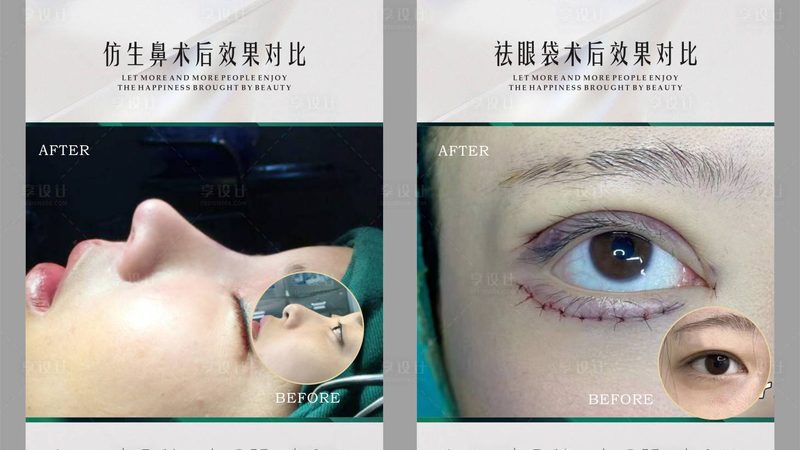 医用玻尿酸：揭秘其背后的奥秘与选购要点**