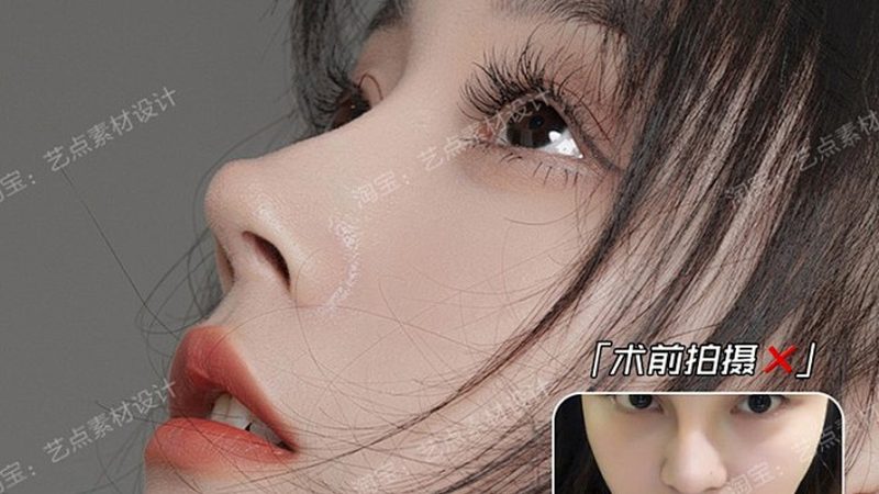 IPL激光祛斑仪加盟代理：揭秘技术原理与市场趋势
