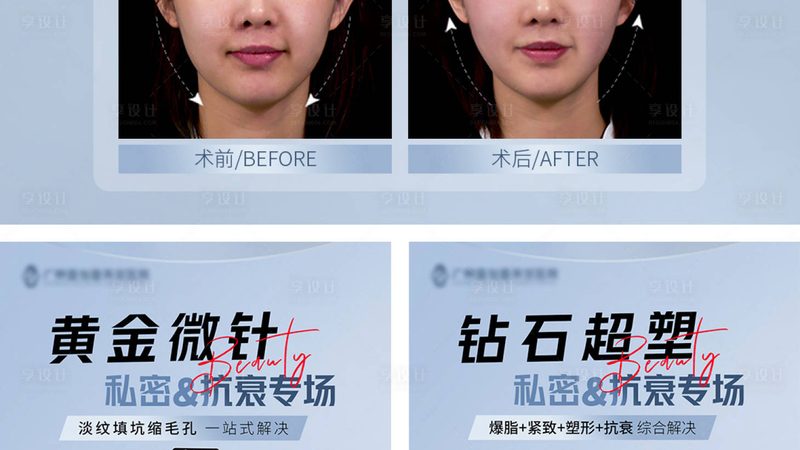 激光美容后，你的皮肤护理这样做**