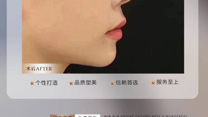哪种注射美容维持时间最长