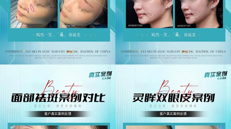 无锡整形医院正畸科：揭秘牙齿矫正的科学之路