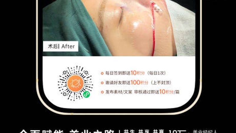 瘦脸按摩仪家用适合敏感肌吗