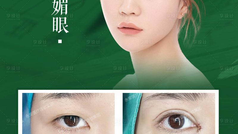 光子嫩肤术后，这些注意事项你做到了吗？**