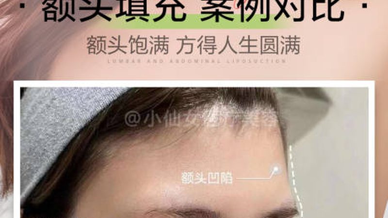 热玛吉操作揭秘：步骤详析与注意事项**
