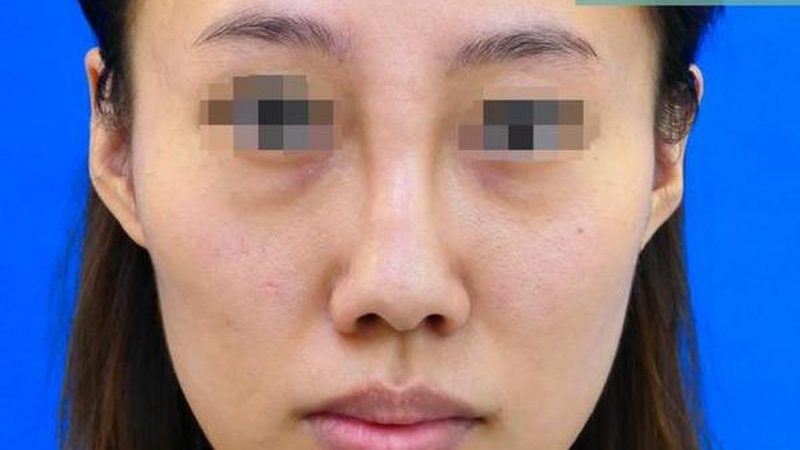 宁波微整形注射，如何选择合适的产品与价格？**